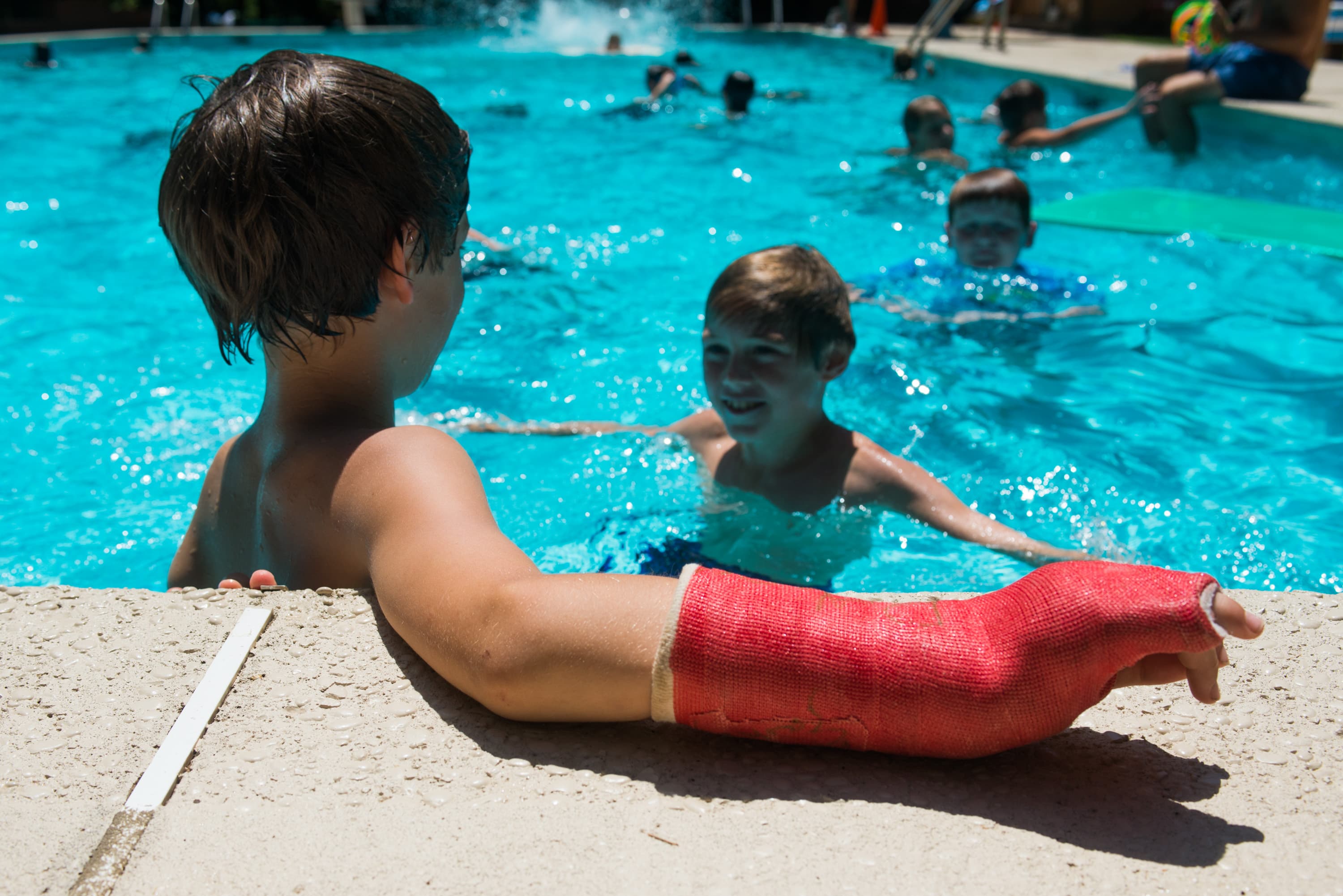 A child with a red cast on their arm sits at the edge of a swimming pool, while other children swim in the water.